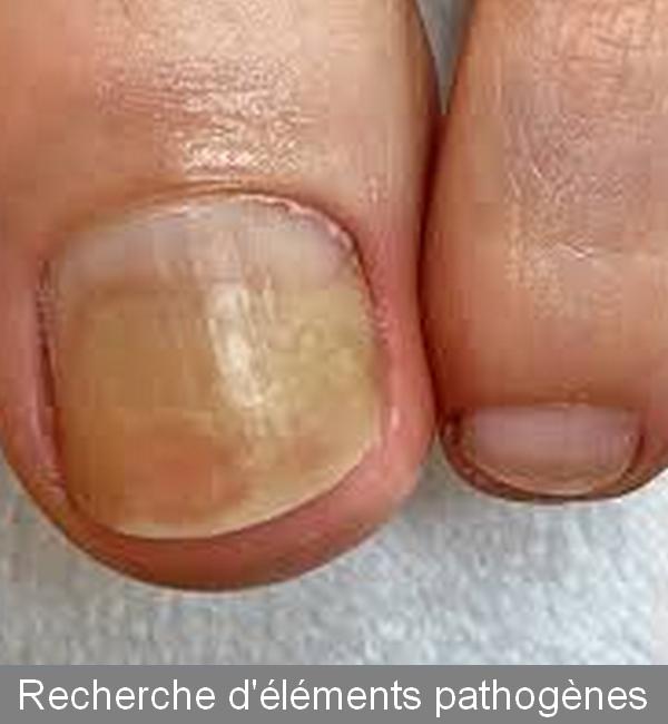 Recherche des éléments pathogènes