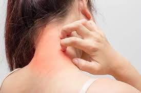 Traitement des allergies cutanées à perpignan